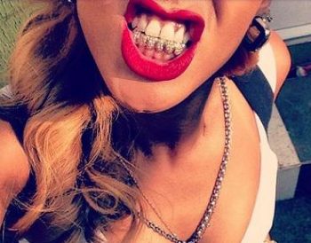 Niebezpiecznie modne zęby – GRILLZ ozdabiane zębów.