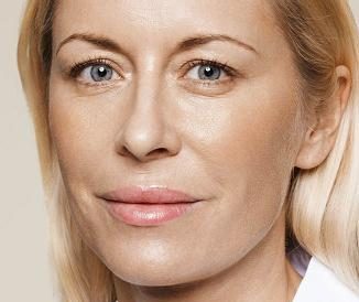 Nawilżanie skóry – ZABIEG RESTYLANE SKINBOOSTERS. Unikatowa metoda długotrwałego nawilżania i rewitalizacji skóry.